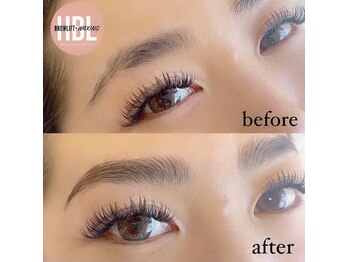 ラナ バイ アンドライフ ショウナン(Lana by andlife Shonan)/HBL ハリウッドブロウリフト