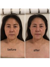 ココ(coco)/小顔モニター様大募集！