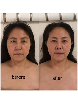 ココ(coco)/小顔モニター様大募集!