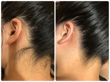 リュミエール(lash&brow lumiere)/うなじ脱毛