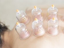 ラグ整体院(rag整体院)/カッピング（吸い玉）