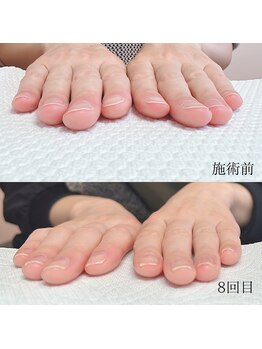 メイル(MEILU)/