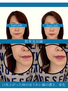 ハリラボ(hari Lab.)/【お客様の声】