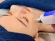 ウィラレア(UILALEA)の写真/満足度の高い《毛穴洗浄コース》で気になる毛穴汚れもすっきり☆自信あふれるすっぴん美肌へ♪