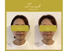 ルク ソル(Luxsol)/骨格調整でお顔を引き上げます！