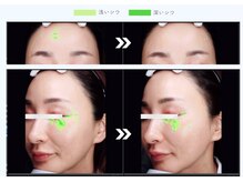 ステラ(STELLA)/１回で30％のシワ改善！