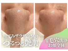 ラノン(Ranon)
