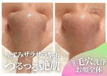 ラノン(Ranon)
