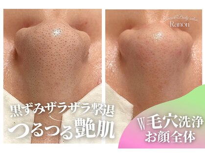 ラノン(Ranon)の写真