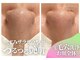 ラノン(Ranon)の写真