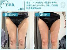 フローフシ∞/【痩身】下半身・お尻の脂肪撃退