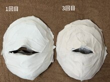 ルアナ(Luana)/小顔ケアの変化　小顔ヘッドスパ