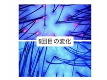 ミエリフル(Miel et Fleurs)の雰囲気（赤く光ってるところは脂分が酸化した所。サビはセルフケアでは×）