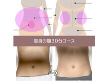 アイビークイーン(I.B.QUEEN)の雰囲気(痩身¥3300キャンペーン実施中!高出力40Kzキャビテーション導入)