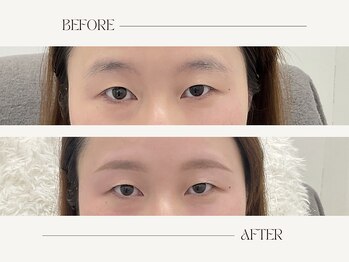 ナキ(Naki)/眉毛施術例 (眉毛Before.After)