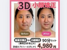 ボディワークス 松戸本店(BODYWORKS)の雰囲気（スッキリ小顔に！）