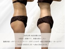 エメ(aimer)/BodyCare《痩身・代謝アップ》