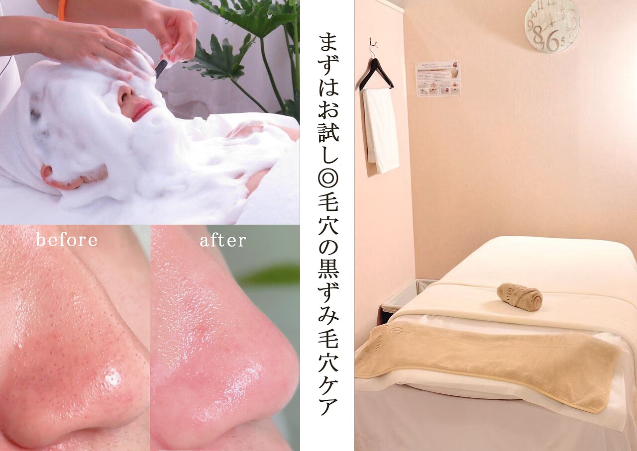 池袋駅で美白エステが人気のエステサロン｜ホットペッパービューティー