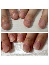 リーフ(Leaf)/自爪形成メニューも人気です