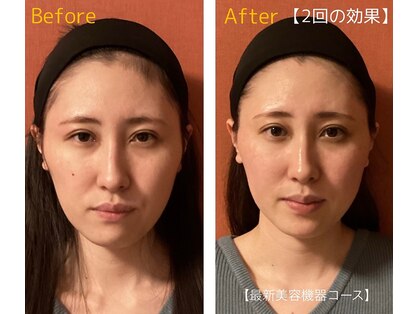 ロイヤリティ(ROYALTY)の写真