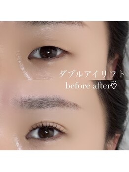 ミリトウキョウハナレ 恵比寿(mm TOKYO Hanare)/ダブルアイリフトで二重に☆