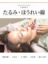 グレースエール トータルビューティーサロン(Grace Aile)&nbsp;たるみ 顔の歪み