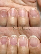 マリーロール 淀屋橋本店(Marie Laure)/自爪育成/深爪矯正/ネイルケア