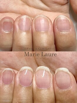 マリーロール 淀屋橋本店(Marie Laure)/自爪育成/深爪矯正/ネイルケア