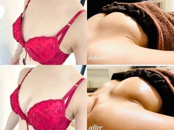 美人バスト 町田店/バストアップ◇症例◇