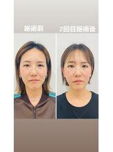 赤沼鍼灸整骨院/美・健康・笑顔に導く美容鍼