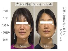 ルピカ(RUPICA)の雰囲気(他メニューとの組み合わせで貴方だけのオーダーメイド施術が可能)