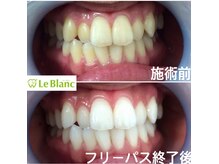 ルブラン 奈良店(Le Blanc)/日々着色はしています！！