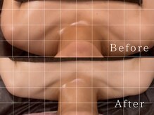 バザルナ(Basaluna)/肩周りの厚みが？！！