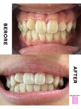 エクシアホワイトニング 王寺店/