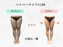 美容整体ウェリナ あま甚目寺院/小顔矯正/骨盤矯正/美脚サロン