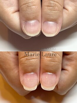 マリーロール 淀屋橋本店(Marie Laure)/自爪育成/深爪矯正/ネイルケア