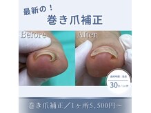 巻き爪補正店 札幌店の雰囲気（トラブル爪は足のスペシャリストにお任せください！）