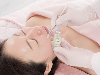 スフィア(Sphere)/シミ・シワはWiQo（ワイコ）