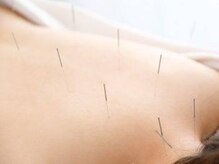 ゆず鍼灸整骨院