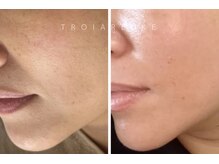 エフエフディースキンケア(FFD SKINCARE)