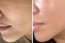 エフエフディースキンケア(FFD SKINCARE)