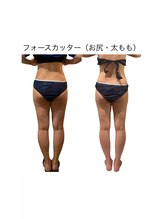 ビーアイリー(Be irie)/痩身エステ フォースカッター