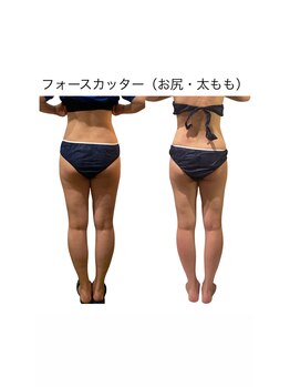 ビーアイリー(Be irie)/痩身エステ フォースカッター