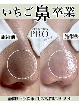 セミル(SEMIRU)/本気の毛穴ケア