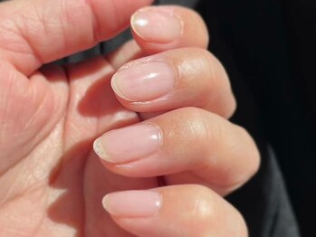 マムコレクションの写真/長年の爪の悩み、一度当店に預けてみませんか?丁寧なケアで色を塗らなくても美しく、自信が持てる指先へ☆