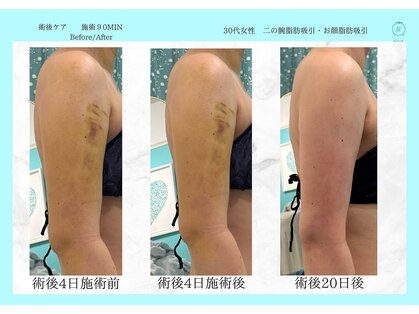 ノット(KNOT)の写真