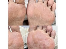 エクラプラス(Eclat.plus)の雰囲気（フットケア・角質ケア・巻き爪ケア・深爪ケア）