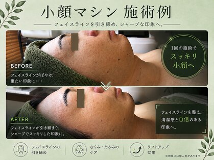 シゼン 恵比寿店(S1ZEN+)の写真
