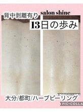 サロンシャイン(Salon Shine)/背中のハーブピーリング