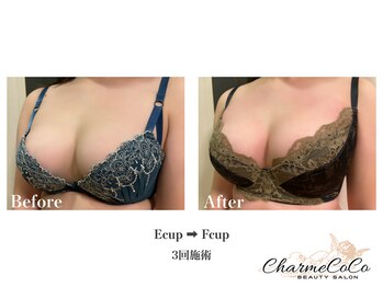 シャルムココ 蔵前店(CharmeCoCo)/お客様Before→After